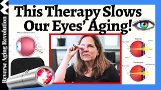 STUNNING Research Shows THIS Therapy Slow The Pace Of Our Eyes' Aging!!!