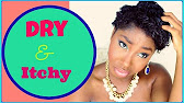 Natural hair | how to get rid of ITCHY SCALP - YouTube