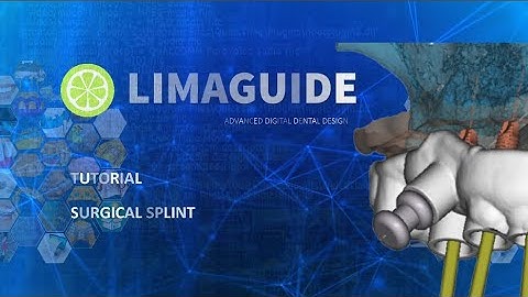 GUIDED SURGICAL GUIDE FOR IMPLANTS