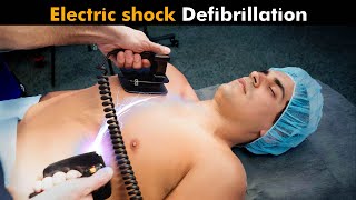 How Defibrillator Works? (Urdu/Hindi)