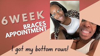 6 Week Braces Appointment | Champagne Gold Braces Journey