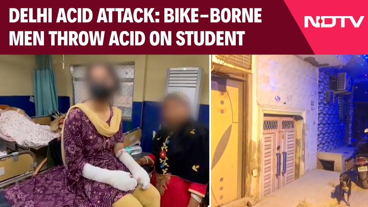 Delhi News | 20-Year-Old Woman Suffers Burn Injuries In Acid Attack In ...