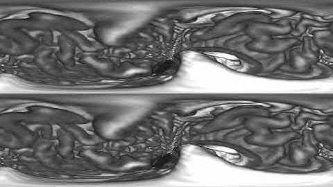Case Study: Brain MRI Data