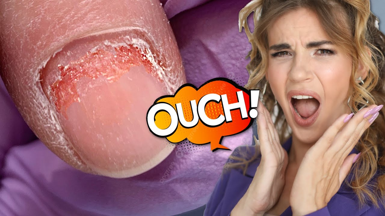 Dry Manicure Gone WRONG 😭