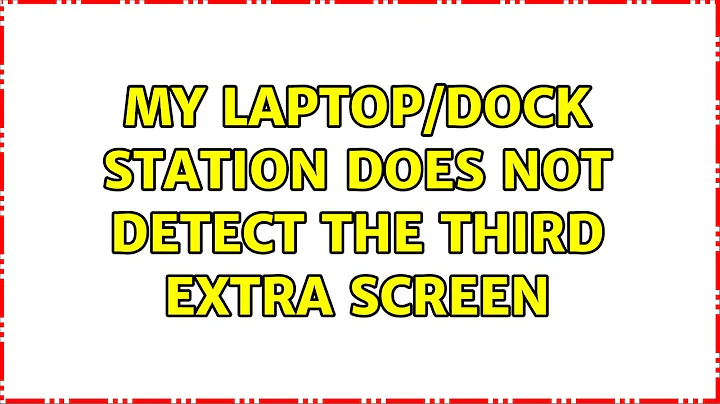 My laptop/Dock station does not detect the third extra screen