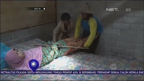 Derita Manusia Kayu, Puluhan Tahun Tubuh Sulit Bergerak  - NET 10