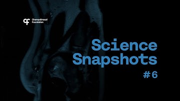 Science Snapshot: Deciphering the Magnetic Signature of Cancer
