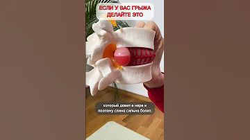 Если у Вас грыжа или протрузия, делайте ТАК