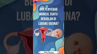 Download Lagu Penyebab Miss v bisa ada benjolan #shorts #infokesehatan MP3