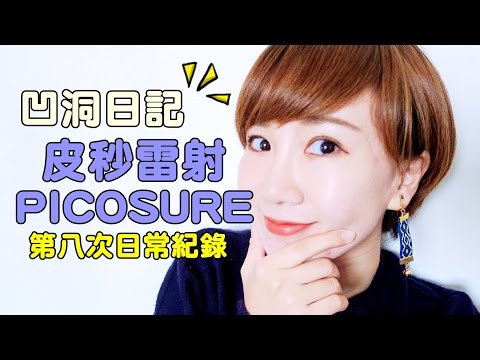 皮秒雷射Picosure 第八次抗戰紀錄｜ 小5cutiefive