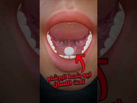 ليه بنحط البرشامة تحت اللسان أسرع امتصاص ولا لأ