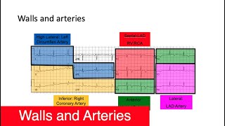 Arteries, Walls, and Leads [Part 4]