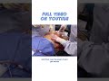 Open Wounds Silicone Removal (Full Video Up Now)