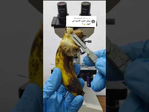 الجزء الأسود في الموز موز