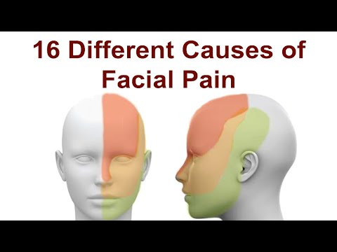 Video: Facial Pain - 7 Main Causes Of Facial Pain, How To Treat?