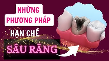 Những phương pháp hạn chế sâu răng | Tt niềng răng quốc tế Diamond