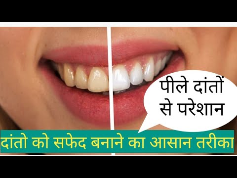 Best whitening toothpaste - YouTube