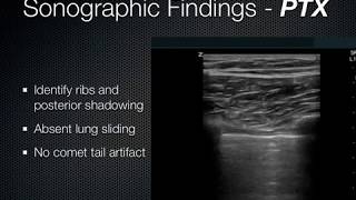 Lung Ultrasound /EFFUSION/CONSOLIDATION