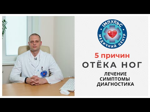 5 причин отёка ног - что делать и как лечить