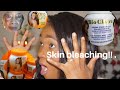 What they don't tell you about Skin bleaching |The  reason why black girls bleach |.