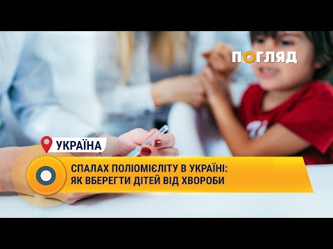 Спалах поліомієліту в Україні: як вберегти дітей від хвороби