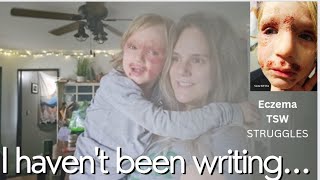 why I haven't been writing|  fighting eczema