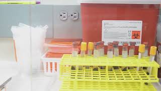 Iredell County Health Department Lab Services