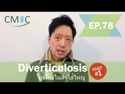วีดีโอ: วิธีการรักษา Diverticulitis (พร้อมรูปภาพ)