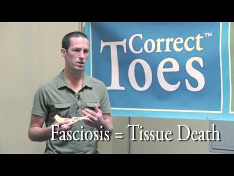 Plantar Fasciitis or Fasciosis?