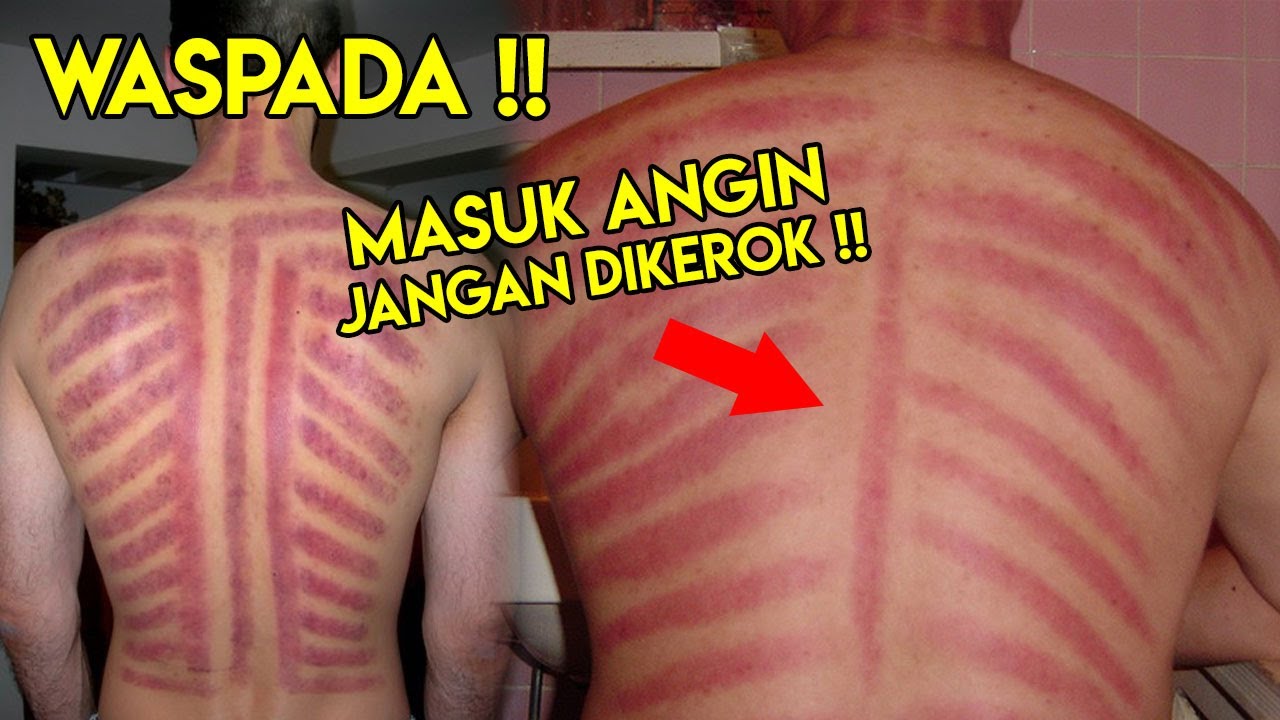 Kebiasaan Orang Indonesia Yang Salah Secara Medis - YouTube
