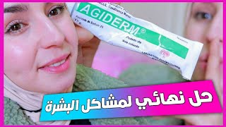 كريم معجزة في تصفية البشرة| إزالة حبوب الوجه- منع ظهور حبوب المناطق الحساسة بعد الحلاقة| AGIDERM