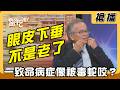 【搶播】眼皮下垂不是老了？一致命病症像被毒蛇咬？