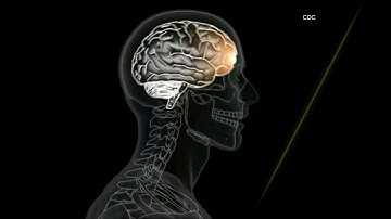 Which symptoms are concussion red flags after you hit your head