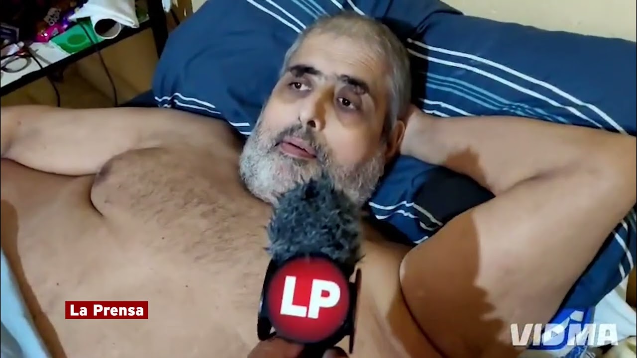 Así ha evolucionado la salud del hombre más obeso de Honduras