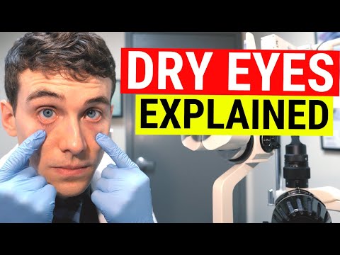 Video: Chronic Dry Eyes: Doctor Discussion Guide