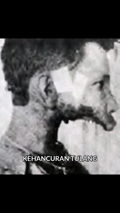 Rahangnya Meleleh Akibat Meminum Zat Radioaktif | Eben Byers #shorts #horrorstories