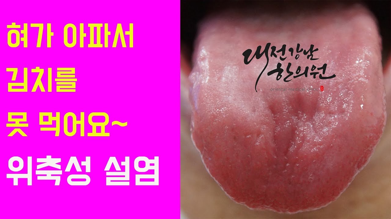 위축성 설염