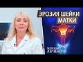 Эрозия шейки матки. Методы лечения