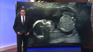 Some doctors, health care providers consider taking career outside of Arizona after Roe V. Wade