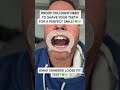 Primo Dental Emax Veneers Loose Fit Test! #shorts