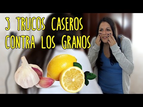 Vídeo: Cómo Deshacerse De Las Espinillas En Los Labios: 12 Remedios Y Tratamientos