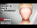 Face blindness: the bizarre condition that stops people recognising faces | 7NEWS Spotlight