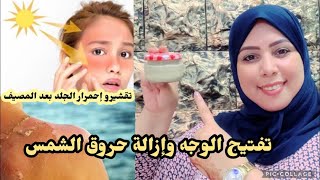 أحسن واقي الشمس جربت في حياتي عندك  حروق الشمس  بعد المصيف 4kتسلخات طفح جلدي الحل عندي