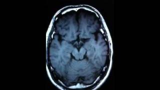 脳 脳 サーキュレーション