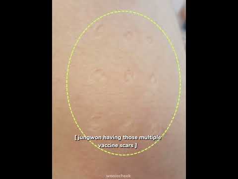jungwon having those multiple vaccine scars enhypen jungwon