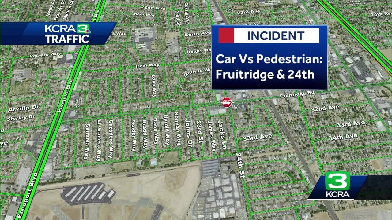 Pedestrian in critical condition after being struck by vehicle in ...