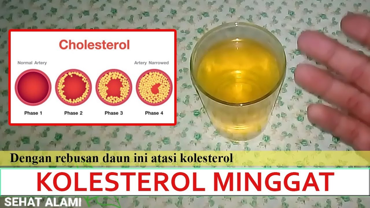 Katakan Putus Pada Kolesterol | Cara Mengobati Kolesterol Dengan Daun