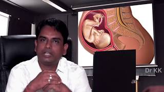गर्भावस्था में संभोग करने का सही तरीका || safe sex positions during pregnancy in hindi | dr.kk