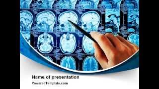 Brain MRI Scan PowerPoint Template by PoweredTemplate.com