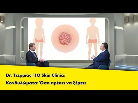 Κονδυλώματα: Όσα πρέπει να ξέρετε | Ο Dr. Τzερμιάς στην εκπομπή «Ίασις»